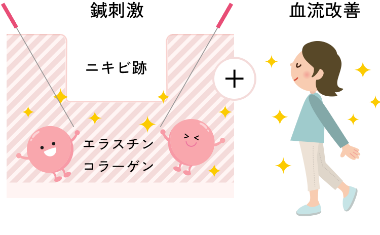 鍼刺激と血流改善によりエラスチン・コラーゲン上昇